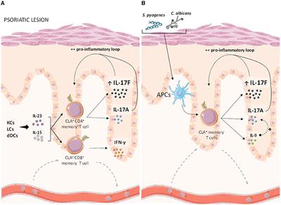 Human CLA+ Memory T Cell and Cytokines in Psoriasis